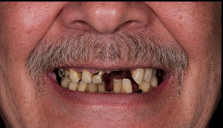 Before treatment